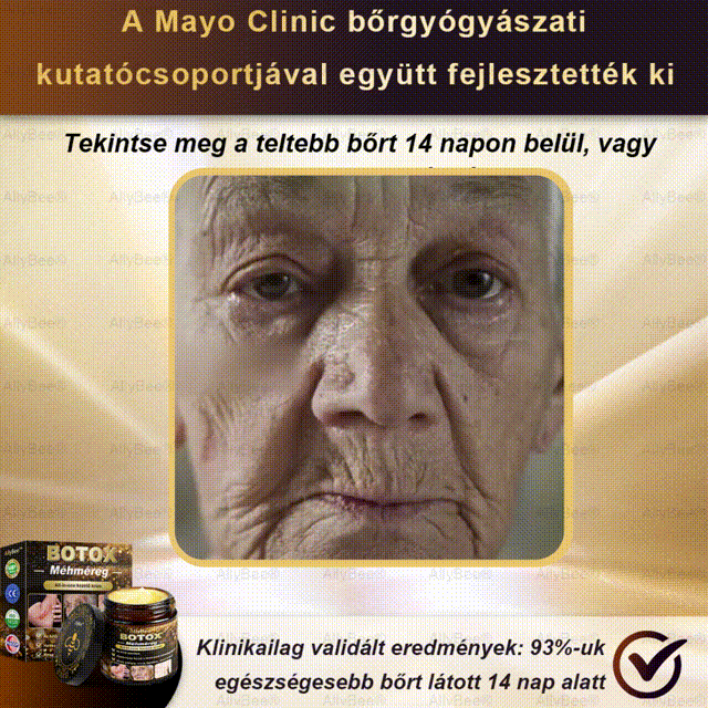 đšâđŹ AllyBeeÂź Botox BĆrĂĄpolĂł KrĂ©m RĂĄnctalanĂtĂĄs, HidratĂĄlĂĄs, BĆrregenerĂĄlĂĄs, Egyenletes BĆrtĂłnus, PattanĂĄs- Ă©s SötĂ©tfolt KezelĂ©s, Szemölcs- Ă©s Anyajegyek EltĂĄvolĂtĂĄsa