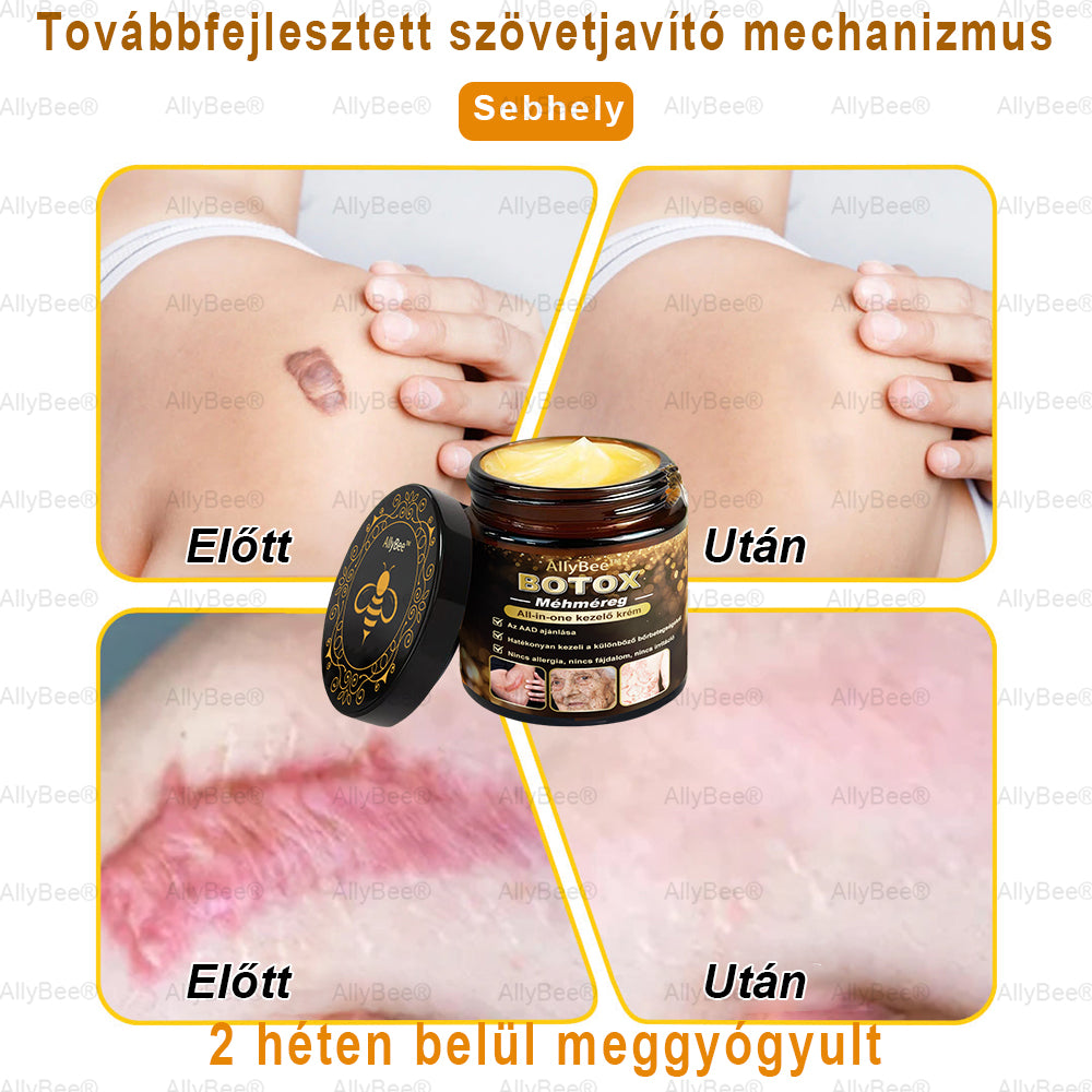 đšâđŹ AllyBeeÂź Botox BĆrĂĄpolĂł KrĂ©m RĂĄnctalanĂtĂĄs, HidratĂĄlĂĄs, BĆrregenerĂĄlĂĄs, Egyenletes BĆrtĂłnus, PattanĂĄs- Ă©s SötĂ©tfolt KezelĂ©s, Szemölcs- Ă©s Anyajegyek EltĂĄvolĂtĂĄsa