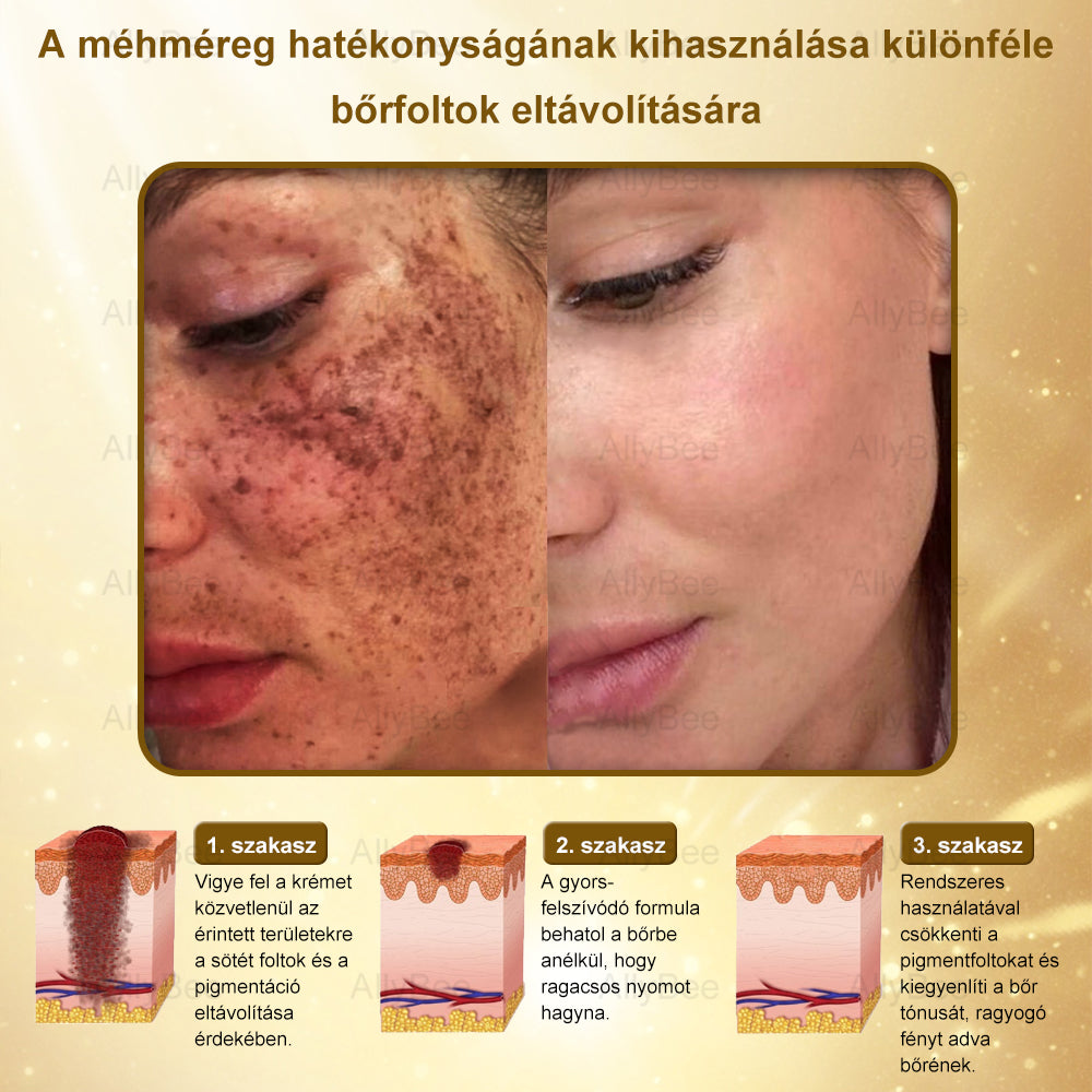 đšâđŹ AllyBeeÂź Botox BĆrĂĄpolĂł KrĂ©m RĂĄnctalanĂtĂĄs, HidratĂĄlĂĄs, BĆrregenerĂĄlĂĄs, Egyenletes BĆrtĂłnus, PattanĂĄs- Ă©s SötĂ©tfolt KezelĂ©s, Szemölcs- Ă©s Anyajegyek EltĂĄvolĂtĂĄsa