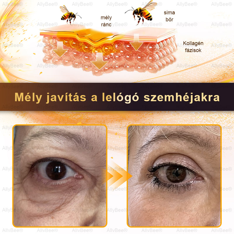 đšâđŹ AllyBeeÂź Botox BĆrĂĄpolĂł KrĂ©m RĂĄnctalanĂtĂĄs, HidratĂĄlĂĄs, BĆrregenerĂĄlĂĄs, Egyenletes BĆrtĂłnus, PattanĂĄs- Ă©s SötĂ©tfolt KezelĂ©s, Szemölcs- Ă©s Anyajegyek EltĂĄvolĂtĂĄsa