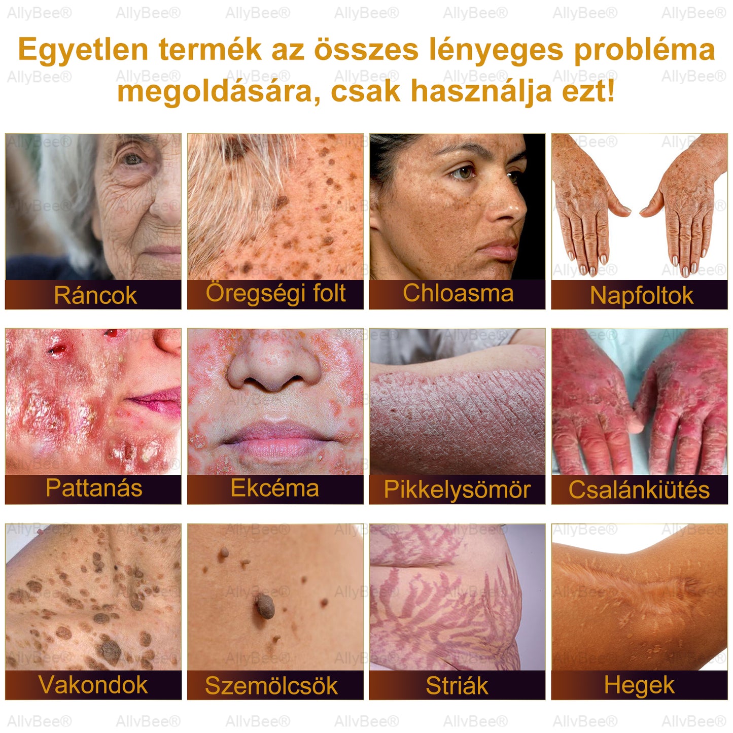 đšâđŹ AllyBeeÂź Botox BĆrĂĄpolĂł KrĂ©m RĂĄnctalanĂtĂĄs, HidratĂĄlĂĄs, BĆrregenerĂĄlĂĄs, Egyenletes BĆrtĂłnus, PattanĂĄs- Ă©s SötĂ©tfolt KezelĂ©s, Szemölcs- Ă©s Anyajegyek EltĂĄvolĂtĂĄsa