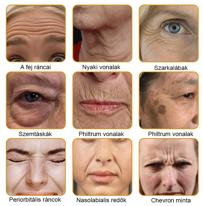 👨⚕️💐Készült és szállított az USA-ból ✅ PLTOWE™ Botox Méhméreg Ránctalanító Krém - Utolsó napi promóció 70% KI