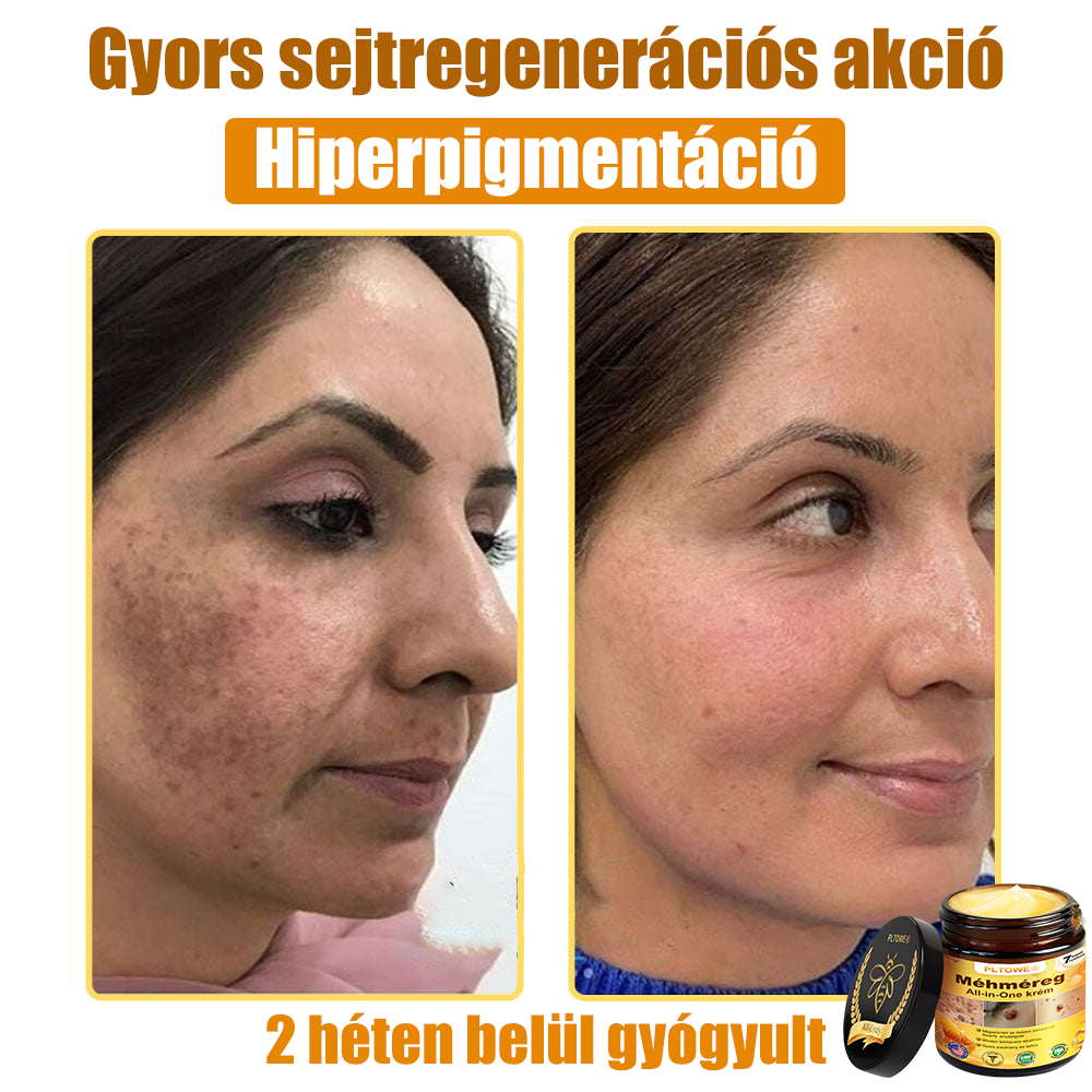 PLTOWE® Méhméreg All-in-One krém AU Bőrgyógyászatilag elfogadott