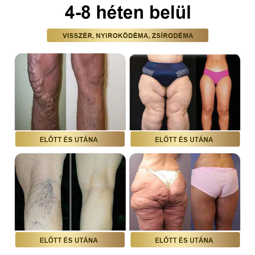 BuildLeaf® 🎁 Már csak 5 doboz maradt! Extra 50% kedvezményt adunk! Legyél fitt és egészséges! Ha most kihagyod, jövőre már nem lesz rá lehetőséged.