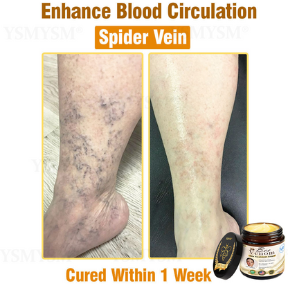 Mayo Clinic Recommended | Official Store | YSMYSM® Full-Body Repair Cream: Anti-Aging, Hydration, Skin Repair, Even Tone, Acne & Dark Spot Treatment, Wart & Mole Removal, Psoriasis Relief
