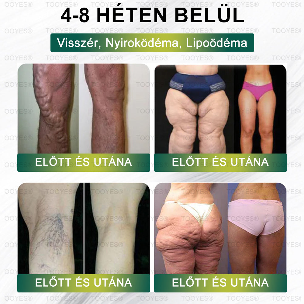 Hivatalos áruház | TOOYES® Meglutide GLP-1 aktiváló belsőleges oldat-Moringa - NAD+ -Yerba Mate-természetes támogatás a karcsúsításhoz, öregedésgátláshoz és a cukoranyagcseréhez 02