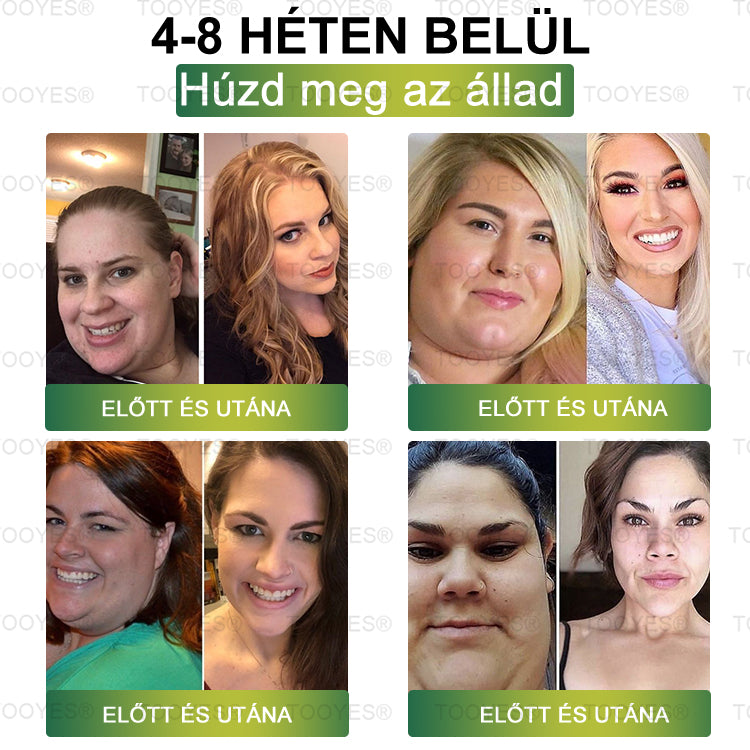 Hivatalos áruház | TOOYES® Meglutide GLP-1 aktiváló belsőleges oldat-Moringa - NAD+ -Yerba Mate-természetes támogatás a karcsúsításhoz, öregedésgátláshoz és a cukoranyagcseréhez 02