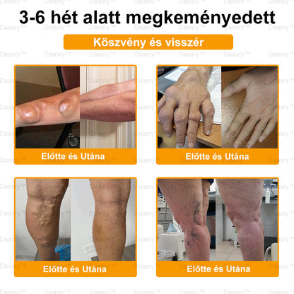 🎁Már csak 5 doboz maradt! Extra 50% kedvezményt adunk! Legyél fitt és egészséges! Ha most kihagyod, jövőre már nem lesz rá lehetőséged.
