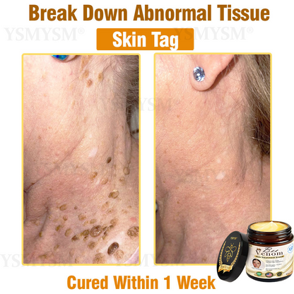 YSMYSM® Powerful All-Body Skin Treatment Cream (Recommended by multiple dermatologists)