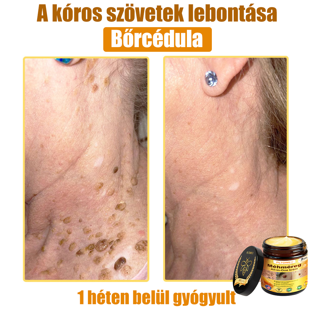 🎁 Már csak 5 doboz maradt! További 50% kedvezményt adunk! Legyél fitt és egészséges! Ha most kihagyod, jövőre már nem lesz rá lehetőséged.