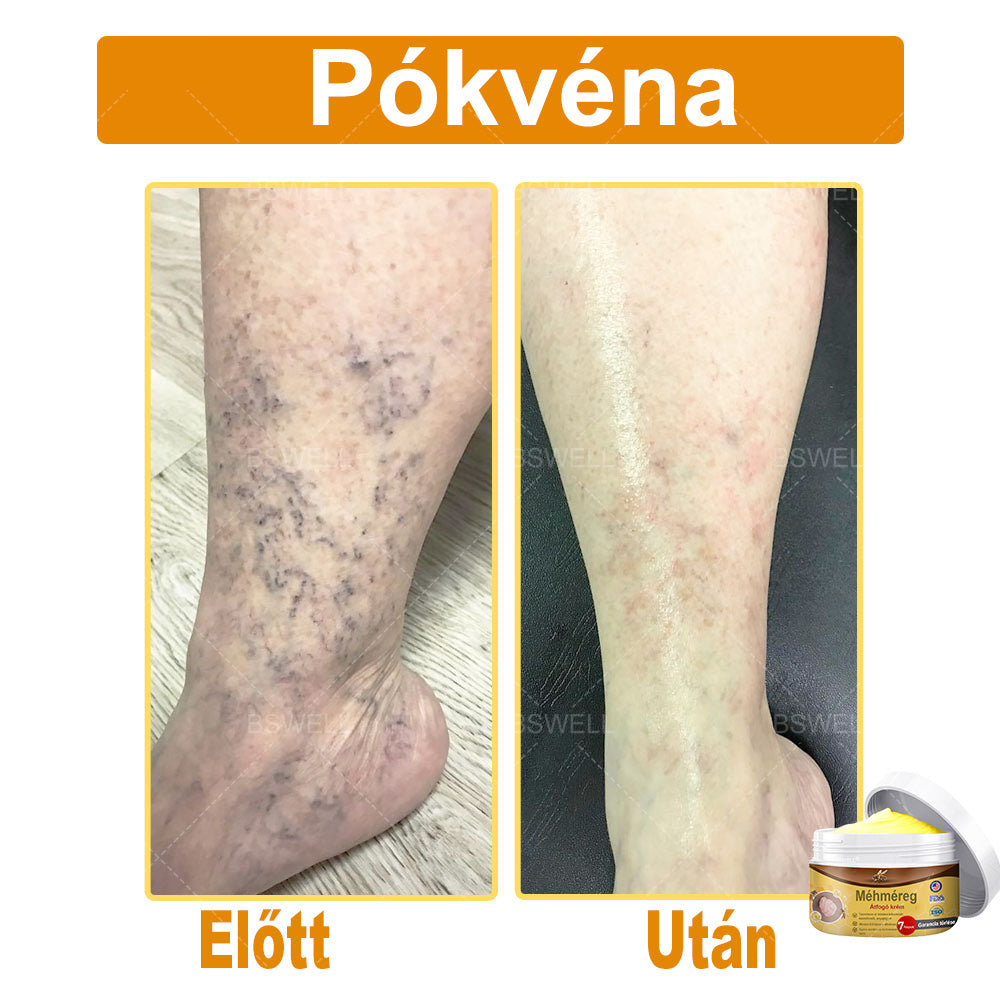 🎁 Már csak 5 doboz maradt! További 50% kedvezményt adunk! Legyen fitt és egészséges! Ha most kihagyod, jövőre már nem lesz rá lehetőséged.🎁