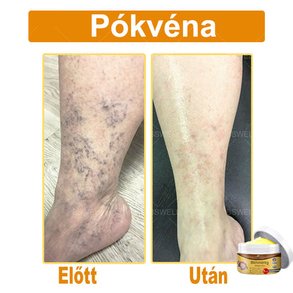 🎁 Már csak 5 doboz maradt! További 50% kedvezményt adunk! Legyen fitt és egészséges! Ha most kihagyod, jövőre már nem lesz rá lehetőséged.🎁