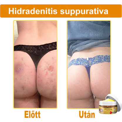 🎁 Már csak 5 doboz maradt! További 50% kedvezményt adunk! Legyen fitt és egészséges! Ha most kihagyod, jövőre már nem lesz rá lehetőséged.🎁