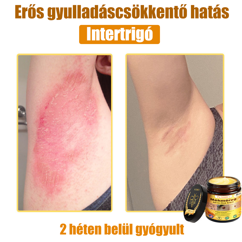 🎁 Már csak 5 doboz maradt! További 50% kedvezményt adunk! Legyél fitt és egészséges! Ha most kihagyod, jövőre már nem lesz rá lehetőséged.