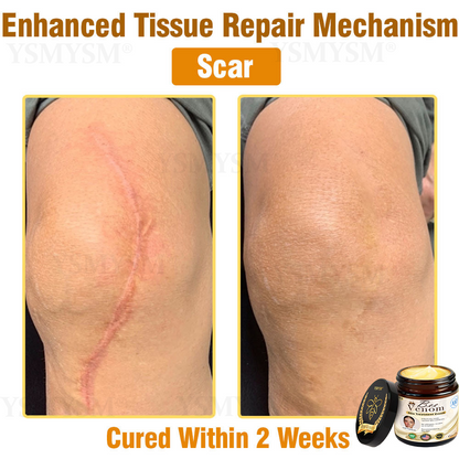Mayo Clinic Recommended | Official Store | YSMYSM® Full-Body Repair Cream: Anti-Aging, Hydration, Skin Repair, Even Tone, Acne & Dark Spot Treatment, Wart & Mole Removal, Psoriasis Relief