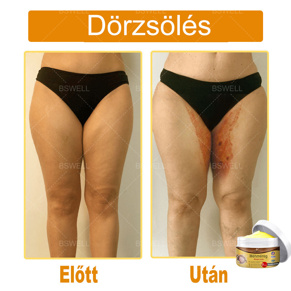 🎁 Már csak 5 doboz maradt! További 50% kedvezményt adunk! Legyen fitt és egészséges! Ha most kihagyod, jövőre már nem lesz rá lehetőséged.🎁