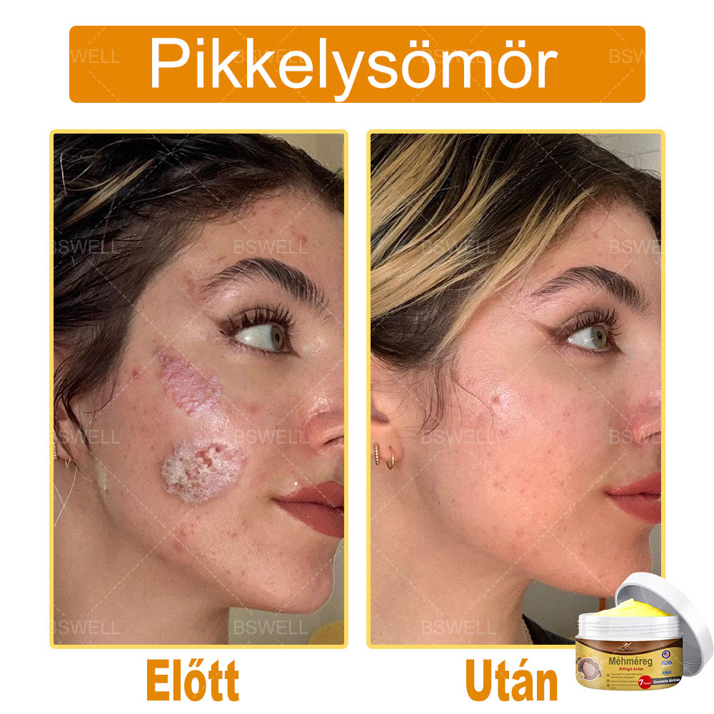 🎁 Már csak 5 doboz maradt! További 50% kedvezményt adunk! Legyen fitt és egészséges! Ha most kihagyod, jövőre már nem lesz rá lehetőséged.🎁