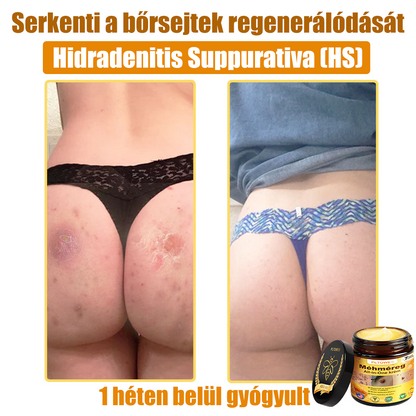 🎁 Már csak 5 doboz maradt! További 50% kedvezményt adunk! Legyél fitt és egészséges! Ha most kihagyod, jövőre már nem lesz rá lehetőséged.