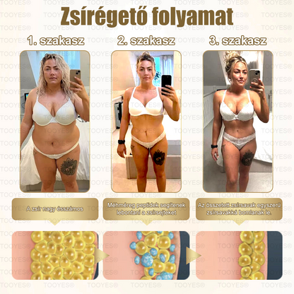 Mayo Clinic Által Ajánlott | Hivatalos Bolt | TOOYES® Metatrolide & Moringa GLP-1 Aktiváció, Almaecet, Kurkuma Gyógyhatású Szájoldat: Elhízás, Szív- és Érrendszeri Betegségek, Cukorbetegség, Alvási Apnoé, Ízületi Problémák és Még Több 👩‍⚕️ 👩‍⚕️