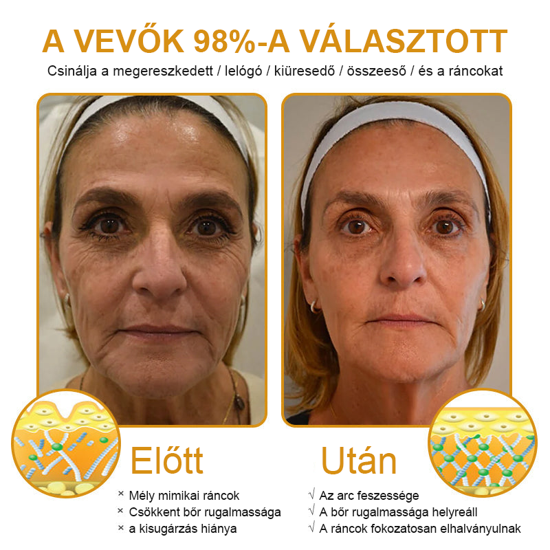 🎁 Már csak 5 doboz maradt! További 50% kedvezményt adunk! Legyél fitt és egészséges! Ha most kihagyod, jövőre már nem lesz rá lehetőséged.