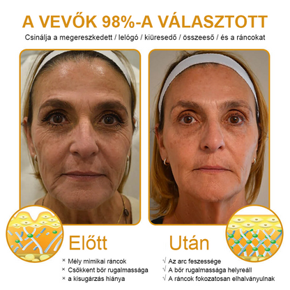 🎁 Már csak 5 doboz maradt! További 50% kedvezményt adunk! Legyél fitt és egészséges! Ha most kihagyod, jövőre már nem lesz rá lehetőséged.