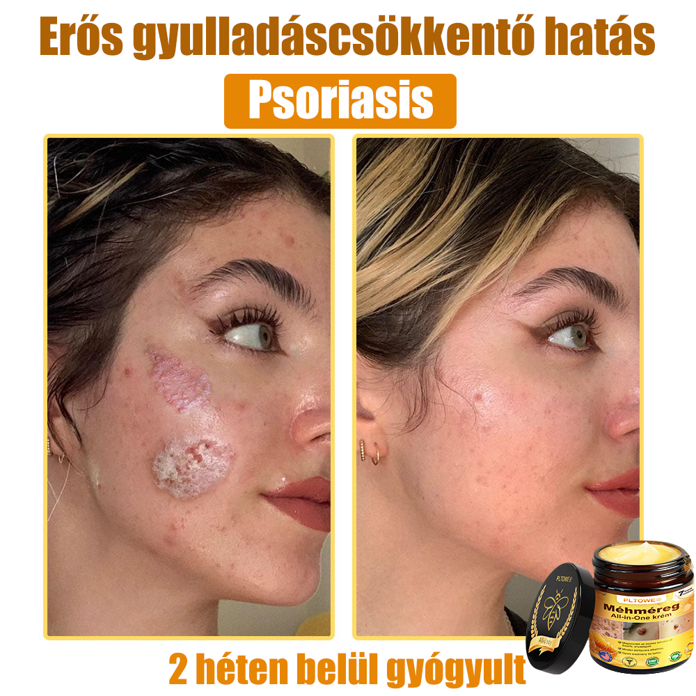 🎁 Már csak 5 doboz maradt! További 50% kedvezményt adunk! Legyél fitt és egészséges! Ha most kihagyod, jövőre már nem lesz rá lehetőséged.