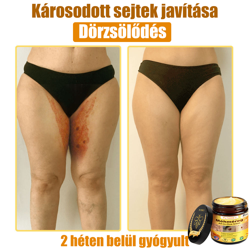 🎁 Már csak 5 doboz maradt! További 50% kedvezményt adunk! Legyél fitt és egészséges! Ha most kihagyod, jövőre már nem lesz rá lehetőséged.
