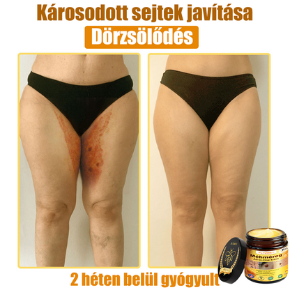 🎁 Már csak 5 doboz maradt! További 50% kedvezményt adunk! Legyél fitt és egészséges! Ha most kihagyod, jövőre már nem lesz rá lehetőséged.
