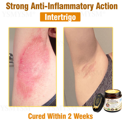 Mayo Clinic Recommended | Official Store | YSMYSM® Full-Body Repair Cream: Anti-Aging, Hydration, Skin Repair, Even Tone, Acne & Dark Spot Treatment, Wart & Mole Removal, Psoriasis Relief