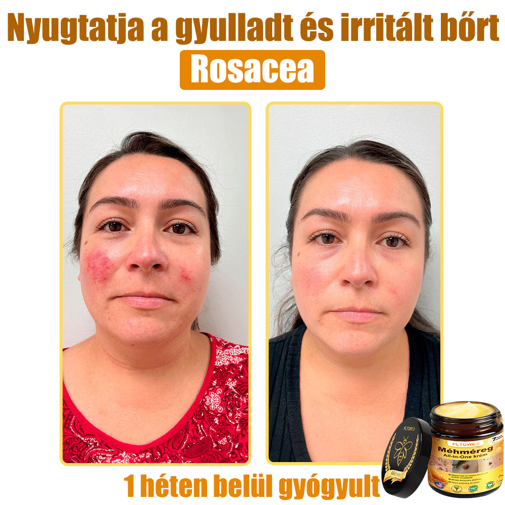 🎁 Már csak 5 doboz maradt! További 50% kedvezményt adunk! Legyél fitt és egészséges! Ha most kihagyod, jövőre már nem lesz rá lehetőséged.