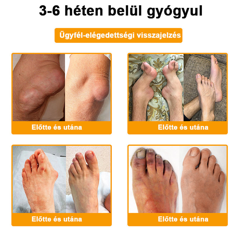 🎁Már csak 5 doboz maradt! Extra 50% kedvezményt adunk! Legyél fitt és egészséges! Ha most kihagyod, jövőre már nem lesz rá lehetőséged.