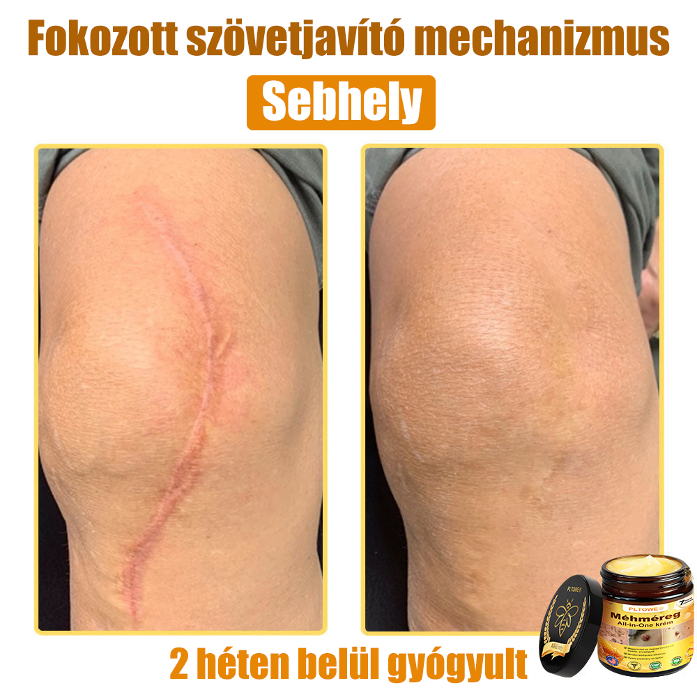 🎁 Már csak 5 doboz maradt! További 50% kedvezményt adunk! Legyél fitt és egészséges! Ha most kihagyod, jövőre már nem lesz rá lehetőséged.