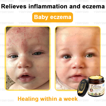 Mayo Clinic Recommended | Official Store | YSMYSM® Full-Body Repair Cream: Anti-Aging, Hydration, Skin Repair, Even Tone, Acne & Dark Spot Treatment, Wart & Mole Removal, Psoriasis Relief